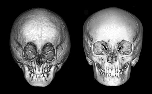 The Case of the Strange Skulls